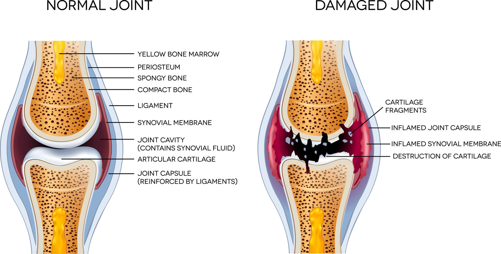 Common Veterinary Medications Used for Dog Arthritis and Their Side Effects